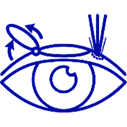 جراحی لیزیک
